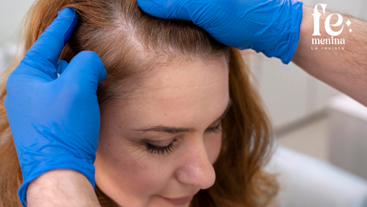 Recomendaciones prácticas para tratar la caída del cabello